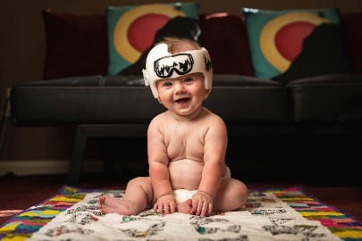 Baby Flat Head Helmet: A Guide to the First 4 Months